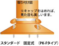 ポストキングスタンダード固定式アンカー止め図